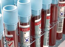 تشکیل دپارتمان تشخیصی HIV در معاونت بهداشت دانشگاه علوم پزشکی مشهد