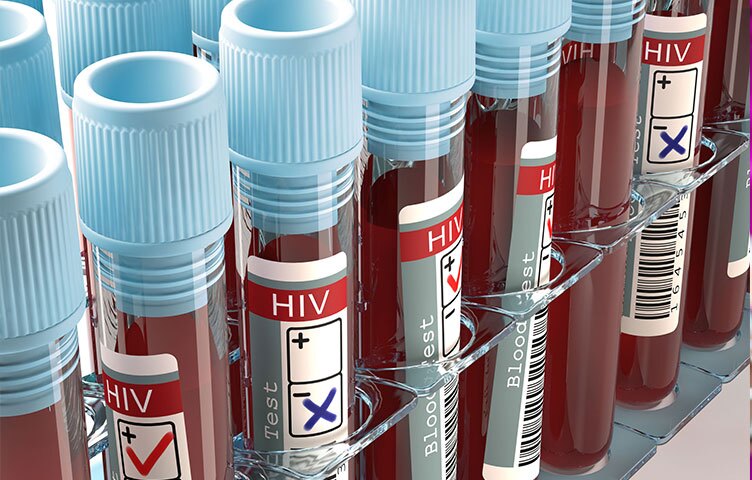 تشکیل دپارتمان تشخیصی HIV در معاونت بهداشت دانشگاه علوم پزشکی مشهد